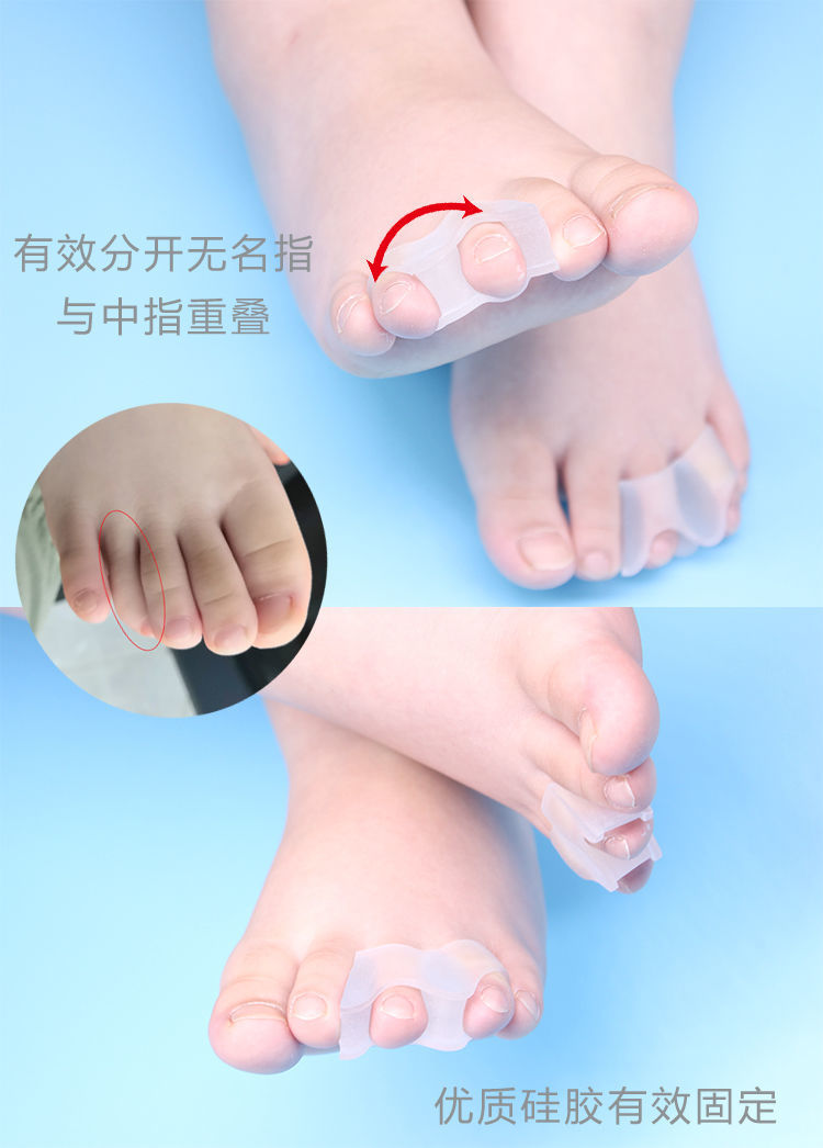 儿童脚趾中指食指重叠第三趾弯曲小拇指内外翻可穿鞋分趾器 m(28-34码