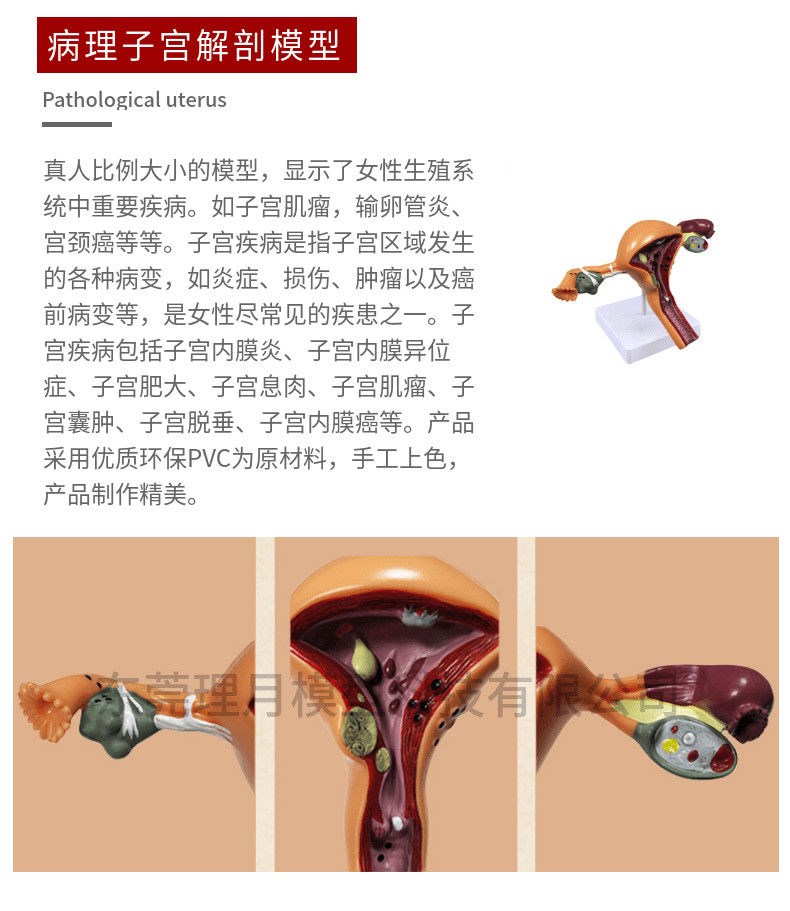 人體子宮模型教具模具陰道卵巢解剖病理醫學女性仿真女性生殖模器病理