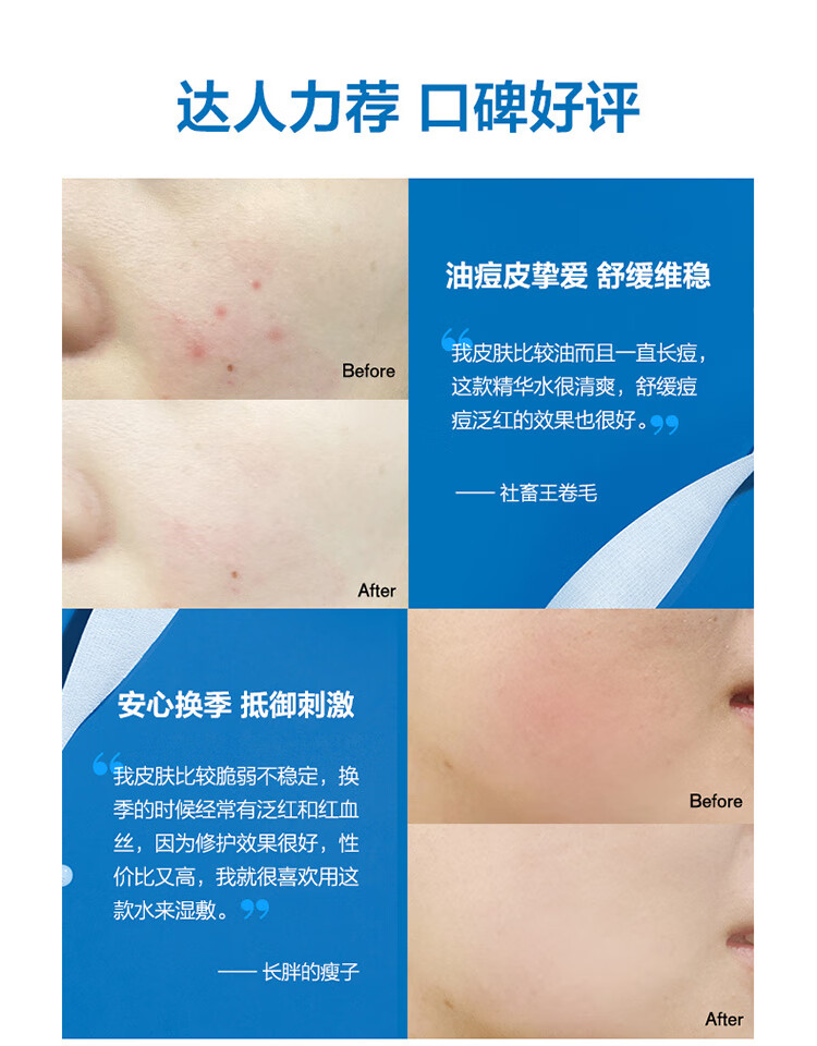 依泉（Uriage）洗面奶洁面乳 舒缓修复洁肤啫喱 CICA积雪草洁面 氨基酸洗面奶 依泉洁肤啫喱200ml