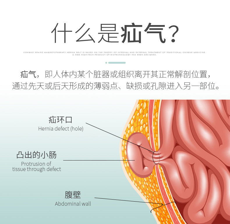 聰慧牌磁療疝氣帶成人型臍疝帶臍疝袋腹壁疝刀口疝切口疝 (療程裝)xl