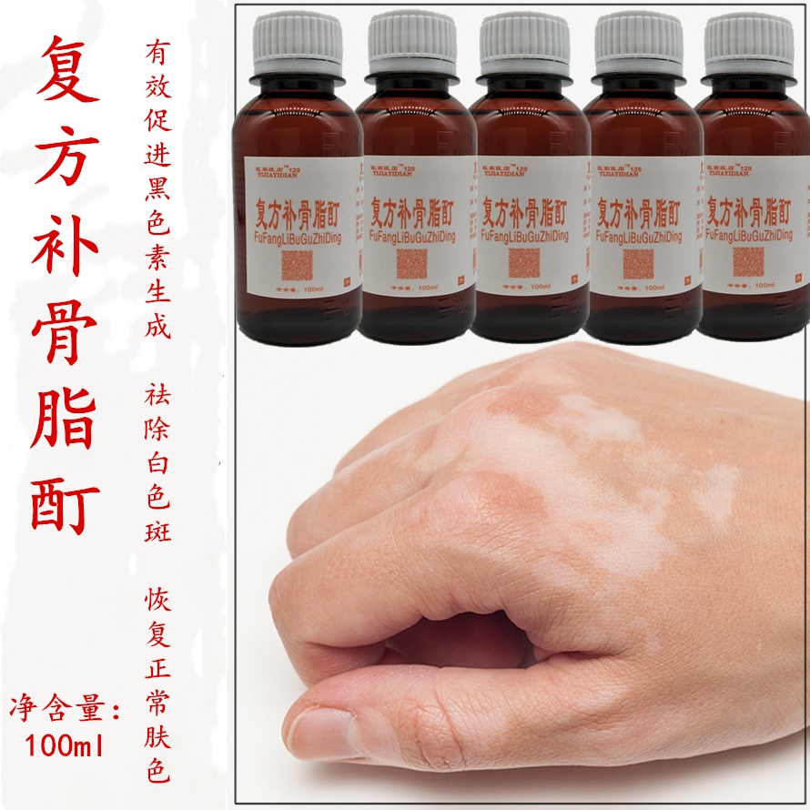复方补骨脂酊外用促黑色素生成净修复液消白宁【图片 价格 品牌 报价