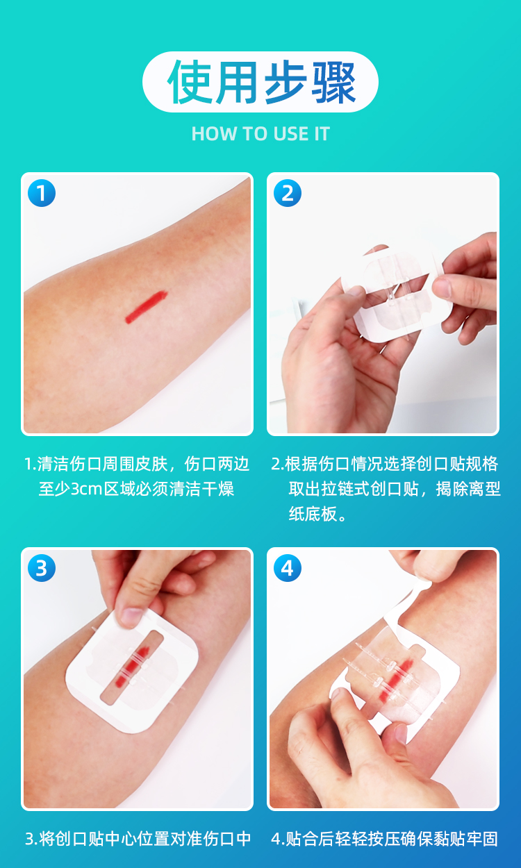 减张器拉链式创口贴皮肤疤痕减张贴儿童张力贴刨腹产术后减张贴创口贴