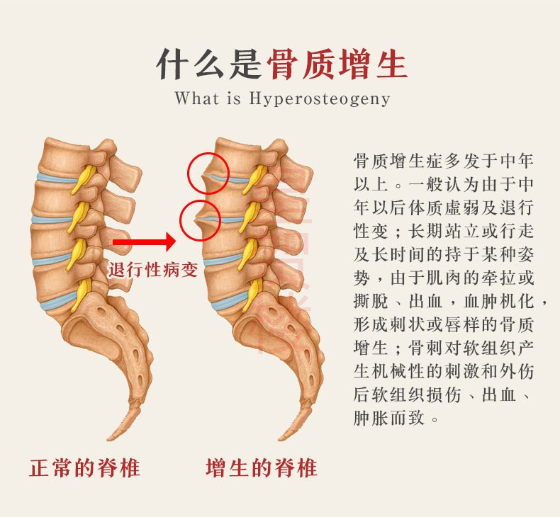 仲云堂腰椎颈椎膝盖骨质增生药监备案冷敷理疗贴可配搭膝关节骨质增生