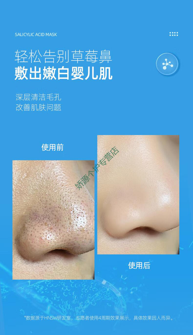 hnsw水杨酸面膜净透清洁细致毛孔控由去黒头保湿水杨酸面膜依漾5瓶