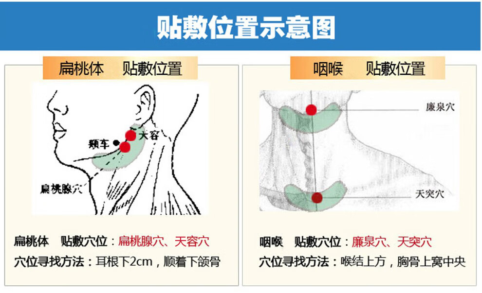 贴敷治咽炎贴的位置图图片