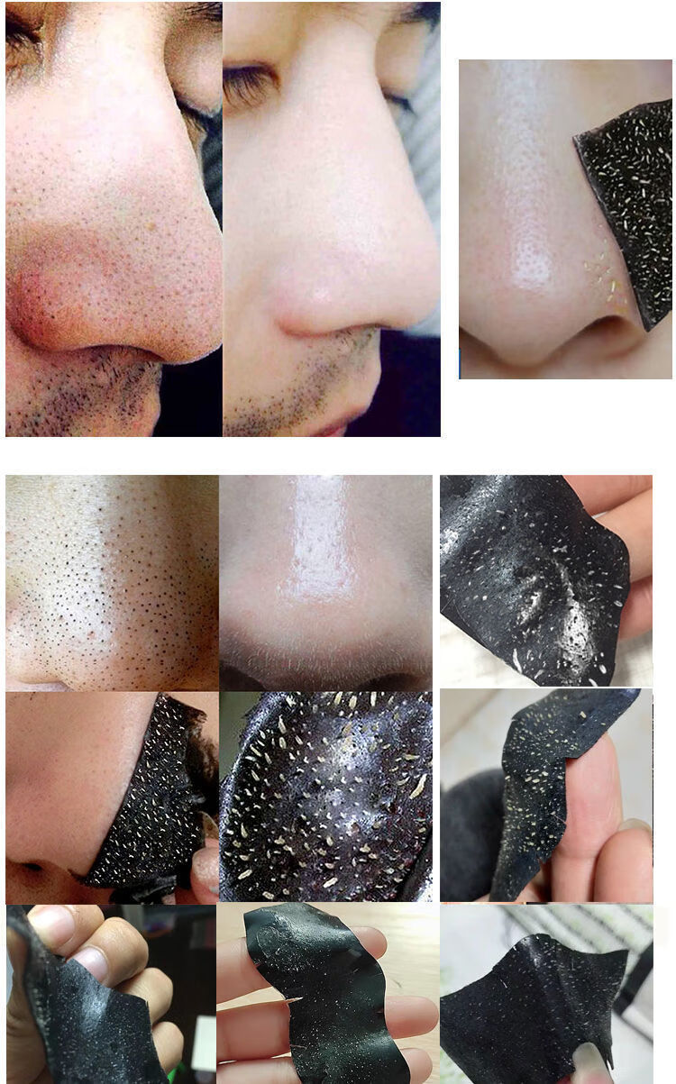 黑头鼻贴抖音黑头粉刺鼻子贴吸黑头收缩毛孔学生螨虫黑头贴黑头鼻贴10