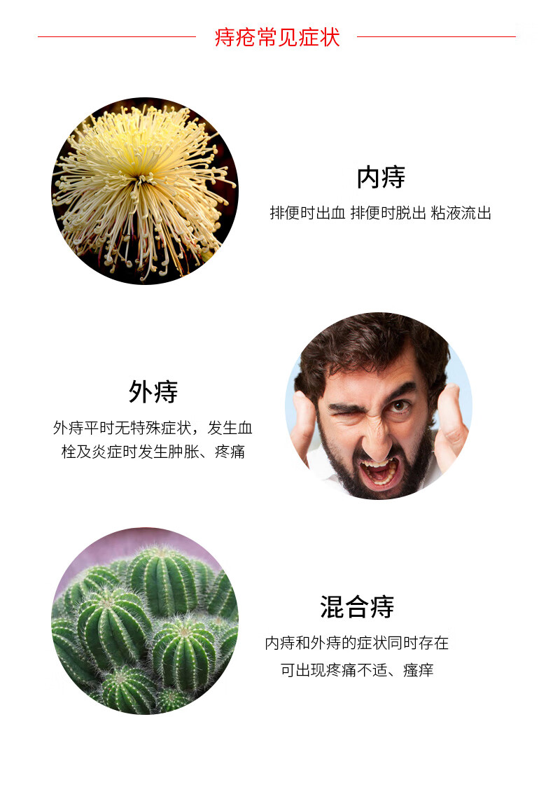 bayer拜耳澳洲原装进口proctosedyl痔疮膏外痔肛裂痔30g消除肉球孕妇