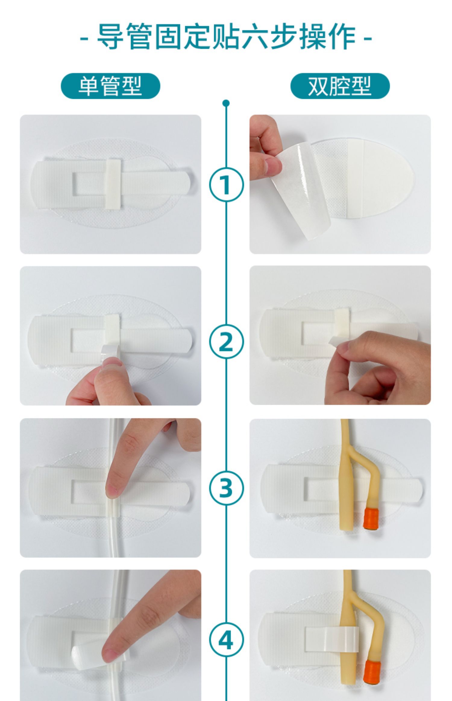 鼻饲管胶布的贴法图片图片