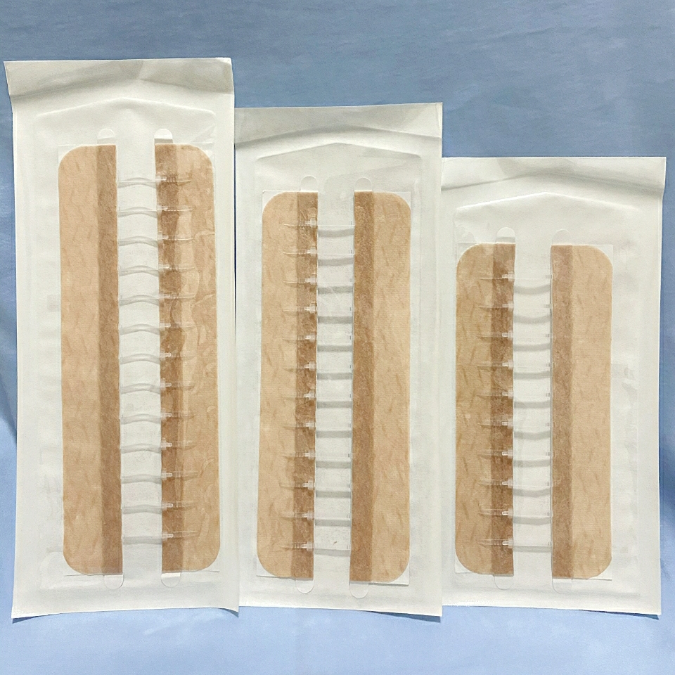 皮肤减张器皮肤表面缝合器立辰减张器皮肤吻合器术后护理155厘米10格