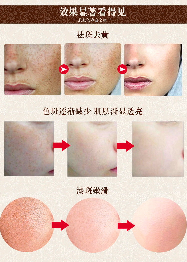 维生素e医用复方熊果苷乳膏医用皮秒修复痘印疤痕淡化斑点祛唇周黑