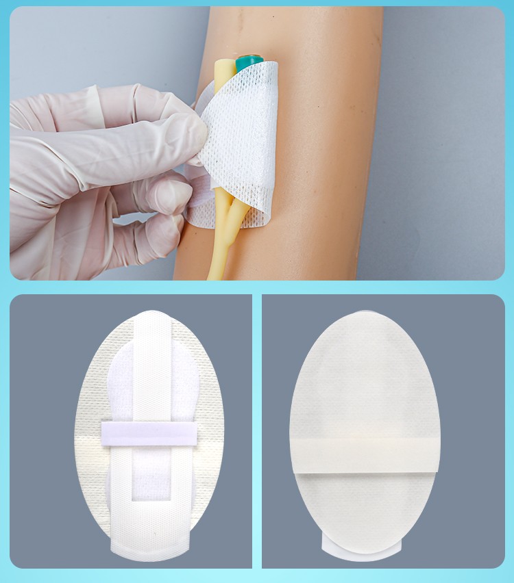 妥能医用导管固定贴体表导管固定装置导尿管固定贴医用导管固定敷料