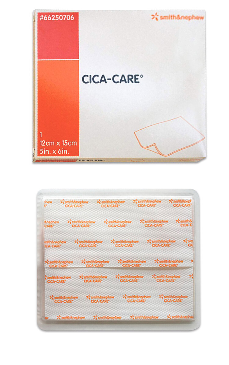 cicacare英国仙卡贴硅胶硅酮凝胶自粘性胶片敷料敌修复剖腹产手术烧