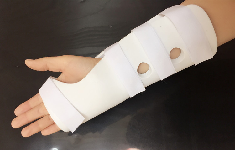 百德莱高分子挠骨骨折夹板手腕扭伤固定支具骨裂护腕后石膏前臂三角