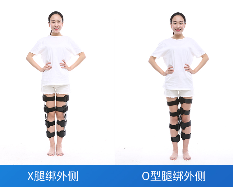 儿童宝宝腿型矫正带o型腿x型矫正支架腿部罗圈腿百倍特矫正器身高141