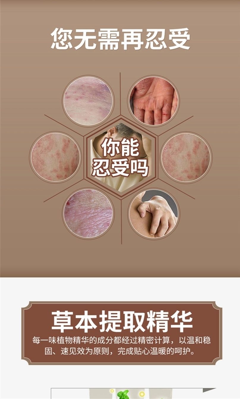 【精选优品】戒之·馆湿清霜成人顽固皮肤瘙痒真菌湿l疹阴囊膏20克 20