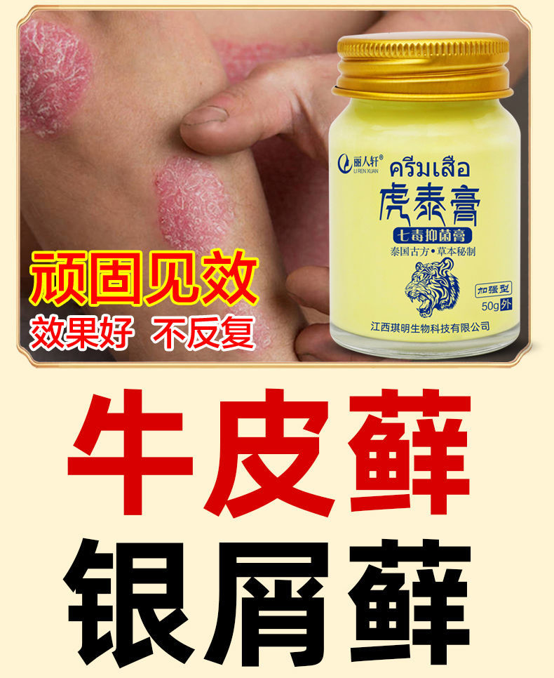 伟博专用虎泰膏头皮癣体癣外用 轻微型1瓶【图片