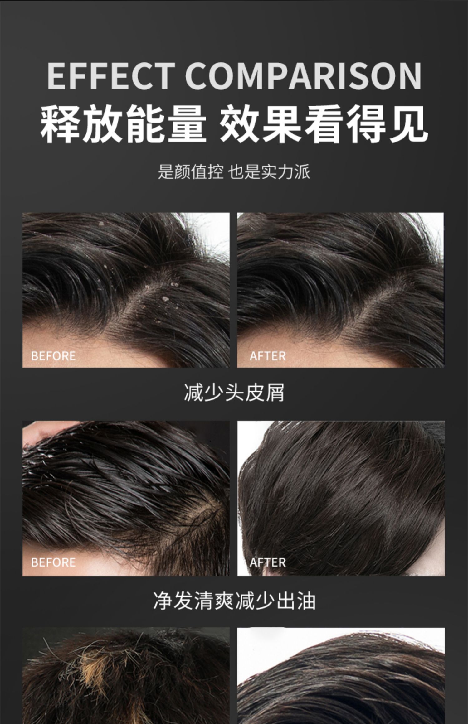 洁芙泉洗发水男士专用去屑止痒蓬松持久留香去油深层清洁洗发露 【除