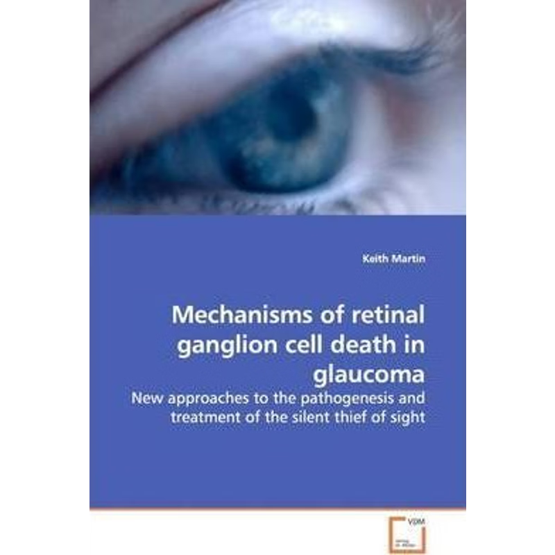 按需印刷Mechanisms of retinal ganglion cell death in glaucoma[9783639161656]