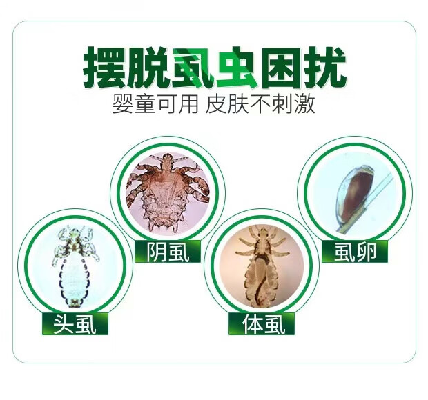 智猪五号去阴虱皇智虱子克星五号头虱一友猪5清虱三净念sal肤圣友
