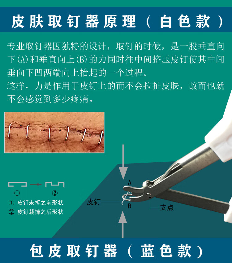 汁寒磐 一次性包皮切割吻合器环切器商环皮肤取钉器医用手术后钛钉拆