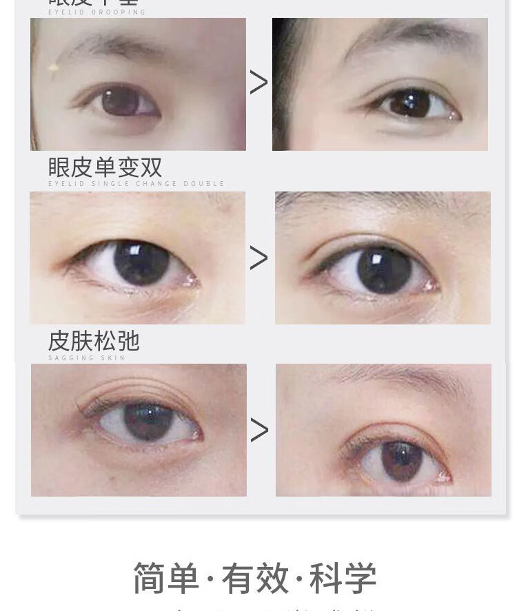 上眼皮松弛下垂修复 提拉紧致嫩肤去脂肪厚肿眼泡浮肿精华液【三瓶装