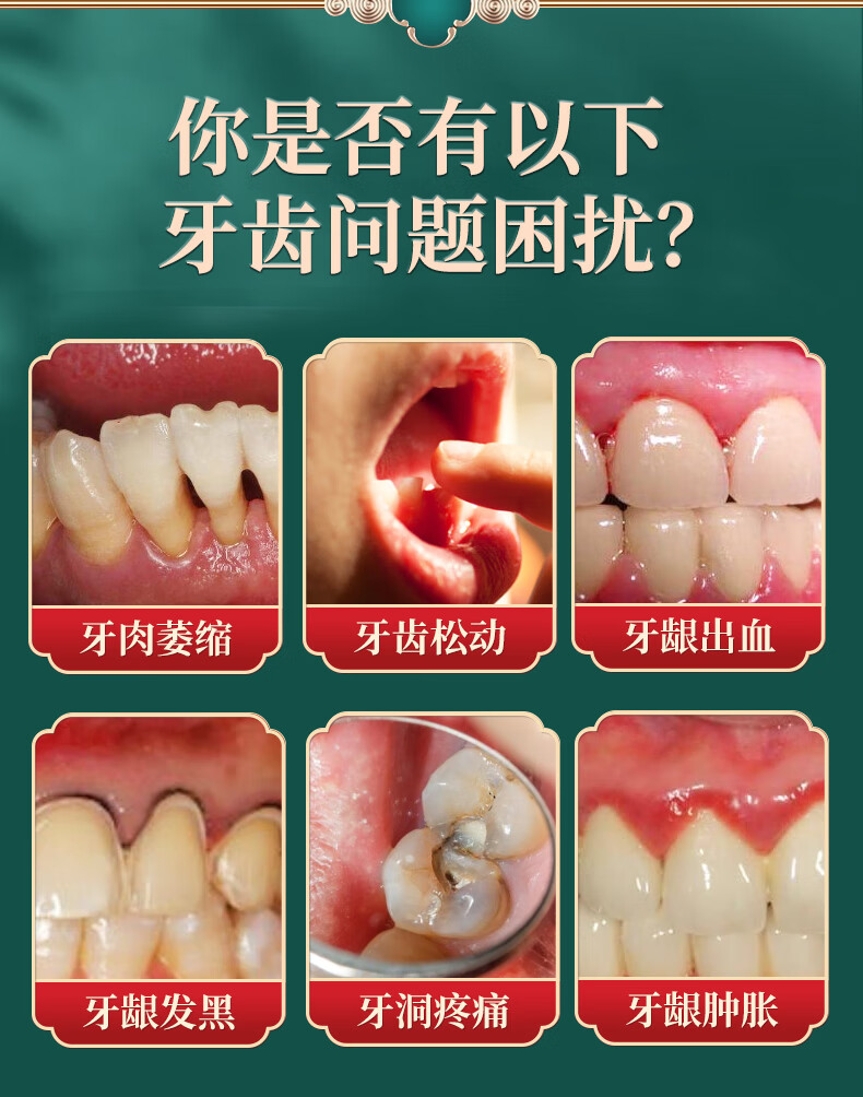 牙龈萎缩安龈散牙龈萎缩修复再生牙齿松动防蛀牙肿痛牙洞牙缝出血固齿