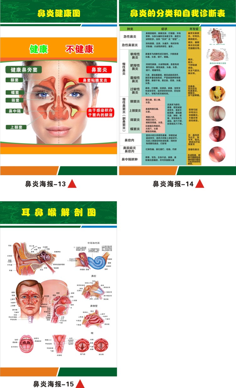 鼻腔结构图解剖挂图耳鼻喉科医院鼻部科普知识海报的症状疾病危鼻炎