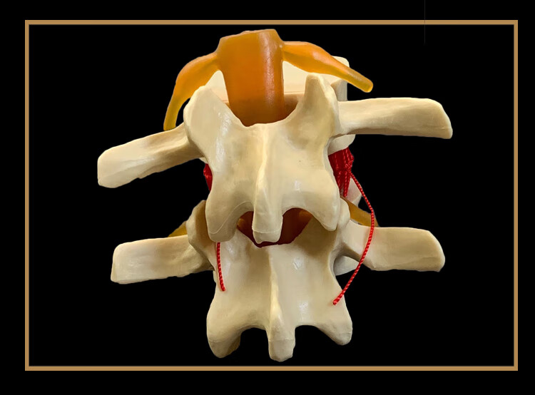 人体腰椎间盘演示模型腰椎模型脊柱模型脊椎模型关节模型娇之乐姜黄色