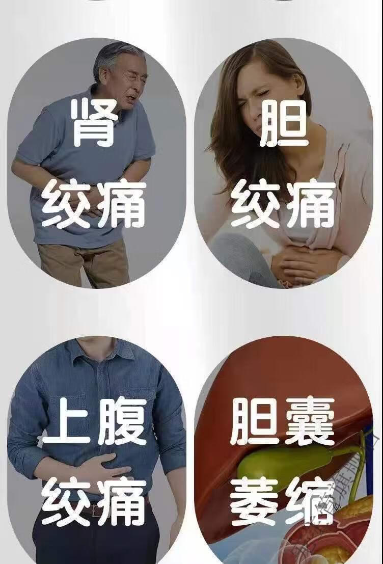 千友浩涛结石随尿排出肾结石肾绞痛尿路结石尿梗阻感染化石排石结石贴