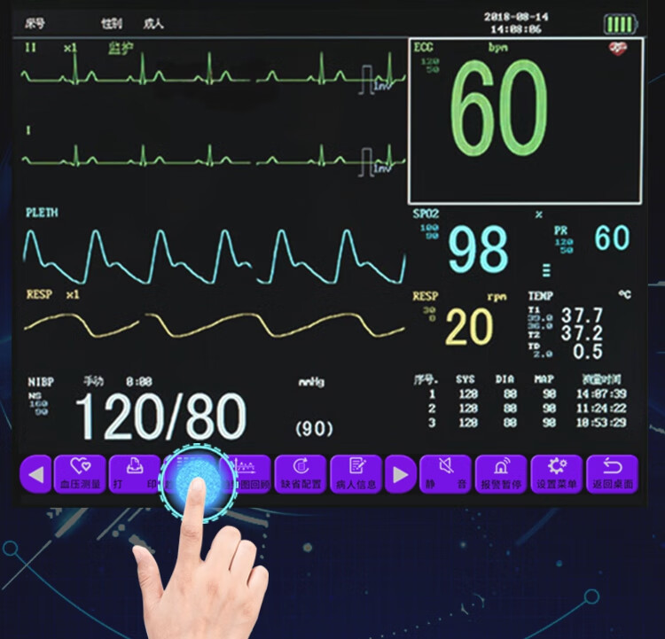 心率监测仪器怎么看图片