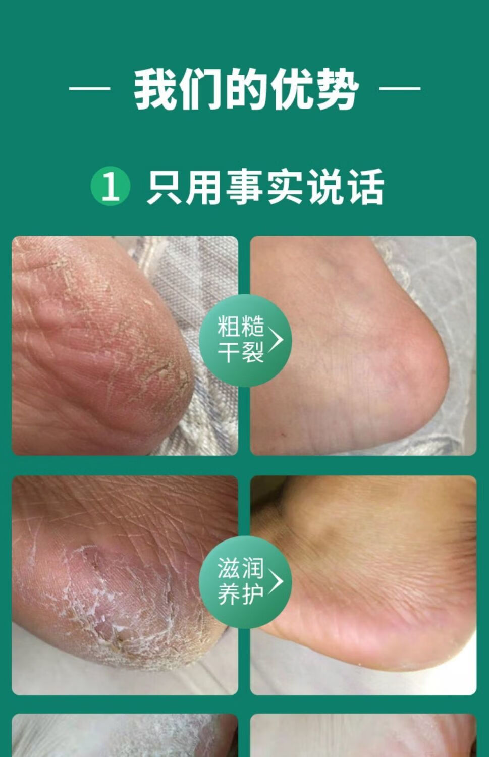 护足霜足裂膏脚后跟手脚干裂去死皮老茧修护霜皲裂膏防冻修复粗糙脱皮