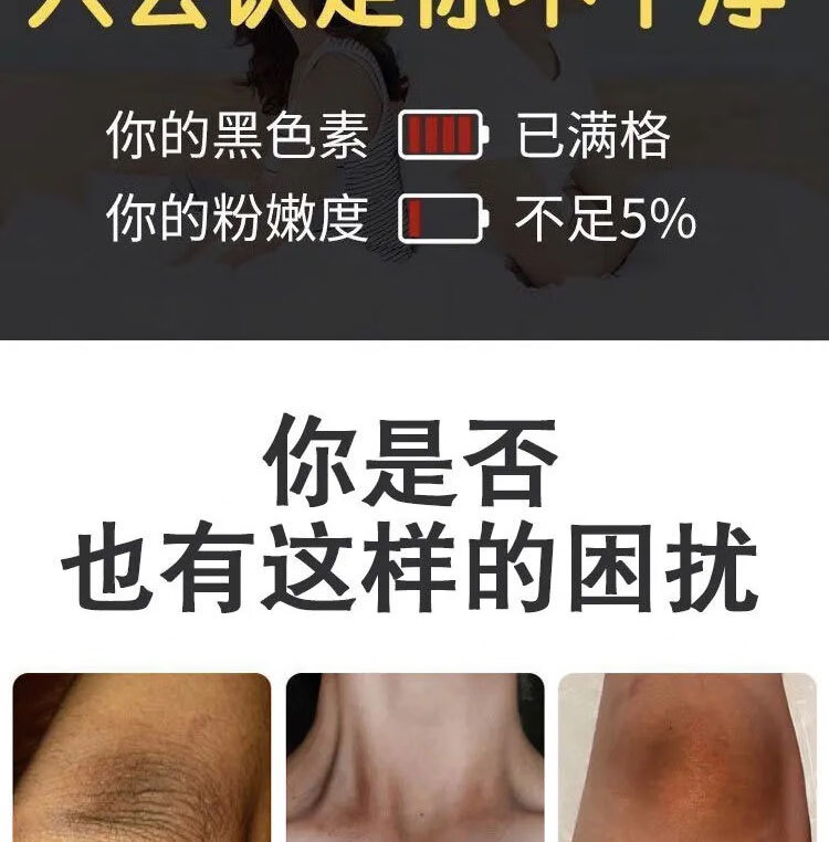 柏俞腚百草之堂草本乳膏脖子黑棘皮症腋窝黑色素屁股沟发黑1盒