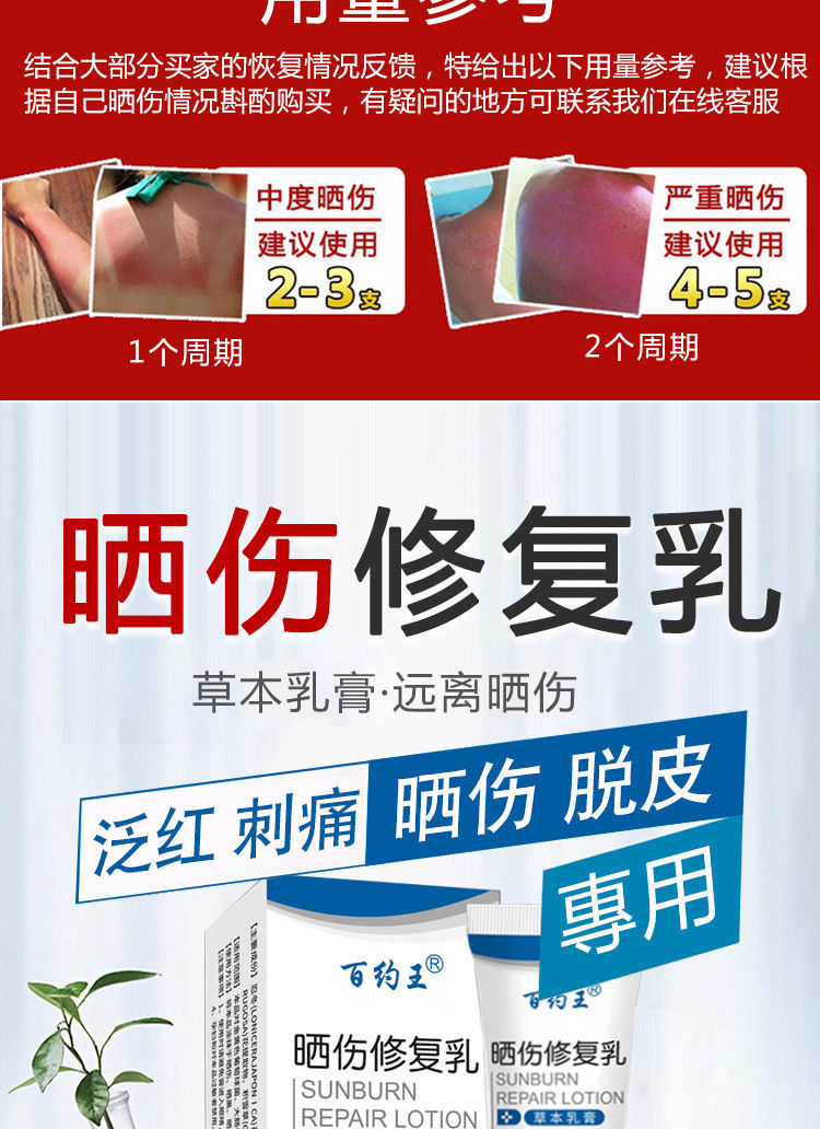 晒伤膏晒后修复过敏脸手脖子背部防l紫外线过敏日光性皮l炎脱皮止痒五
