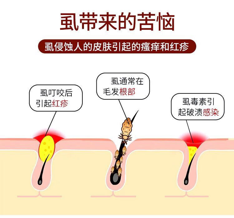 浅米草3号除螨虫图片