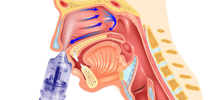 鼻炎喷雾电动式洗鼻器家用鼻腔冲洗 儿童大人 过敏性鼻炎 儿童型 官方