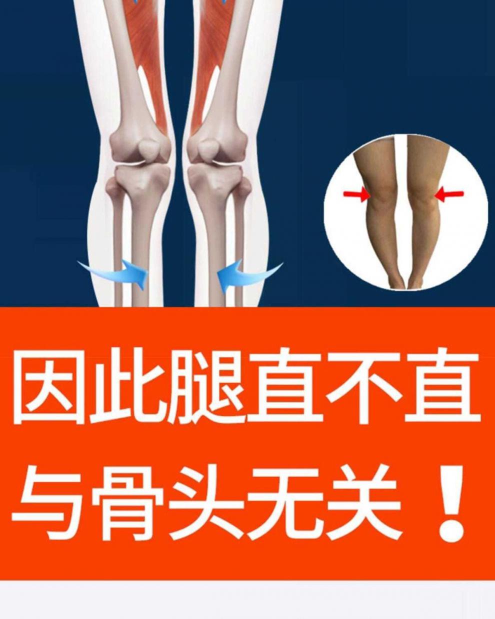 火山磁石鞋垫矫正腿型直腿纠正o型腿矫正鞋垫修正足外翻内八字细腿一