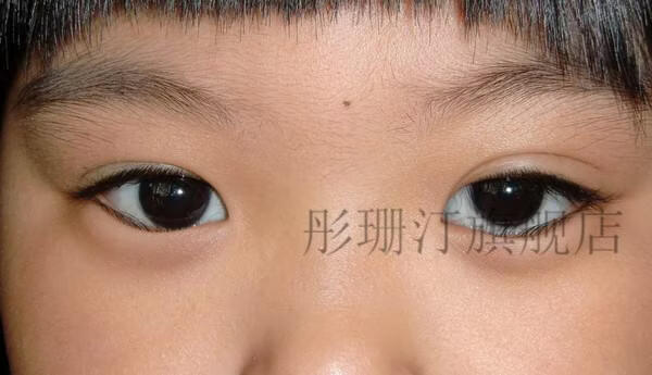 倒睫毛贴倒睫毛眼贴贴倒睫毛儿童小孩倒睫毛胶带下睫毛倒睫胶布试用装