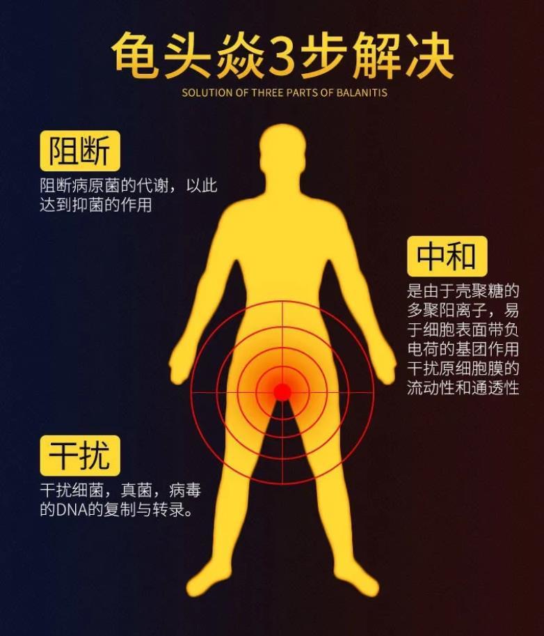 男士银滴虫霉菌性念珠菌洗护液私密处男性清洗液护理液康净宝瘙痒红
