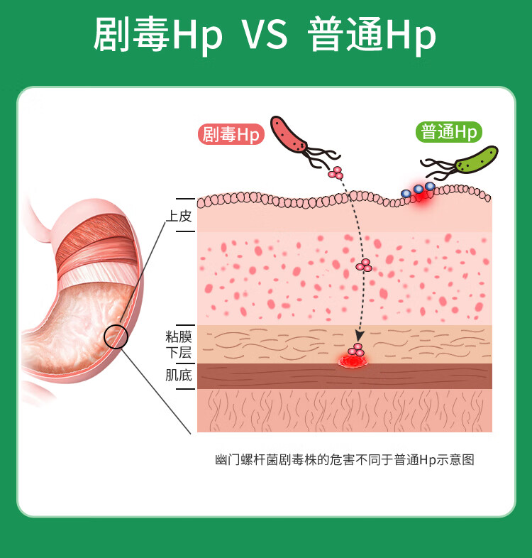 5，康爲世紀（CWBIO）胃幽門螺鏇杆菌核酸檢測非吹氣試紙+劇毒株鋻定無創糞便【機搆檢測】 上門取樣 1人份