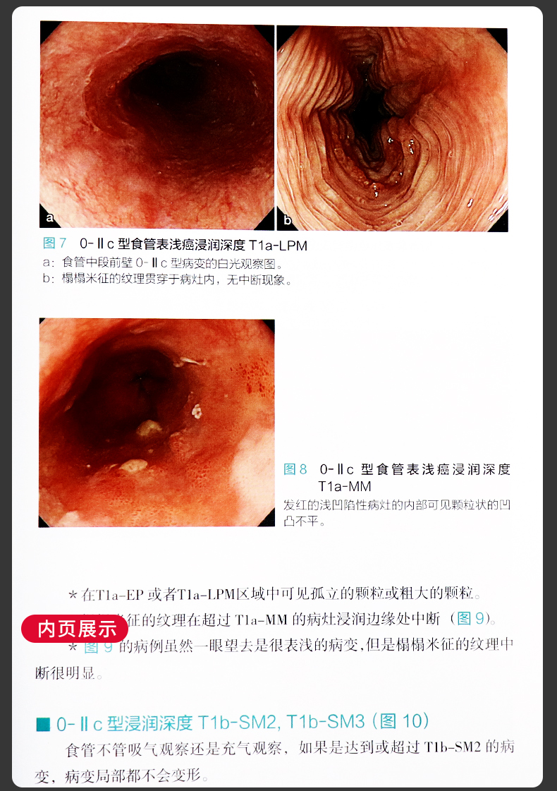 京都胃炎分類上消化道內鏡診斷秘籍放大胃鏡診斷圖譜第2二版三本套裝