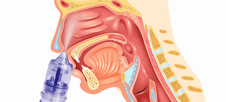 鼻炎喷雾电动式洗鼻器家用鼻腔冲洗 儿童大人 过敏性鼻炎 儿童型 双人
