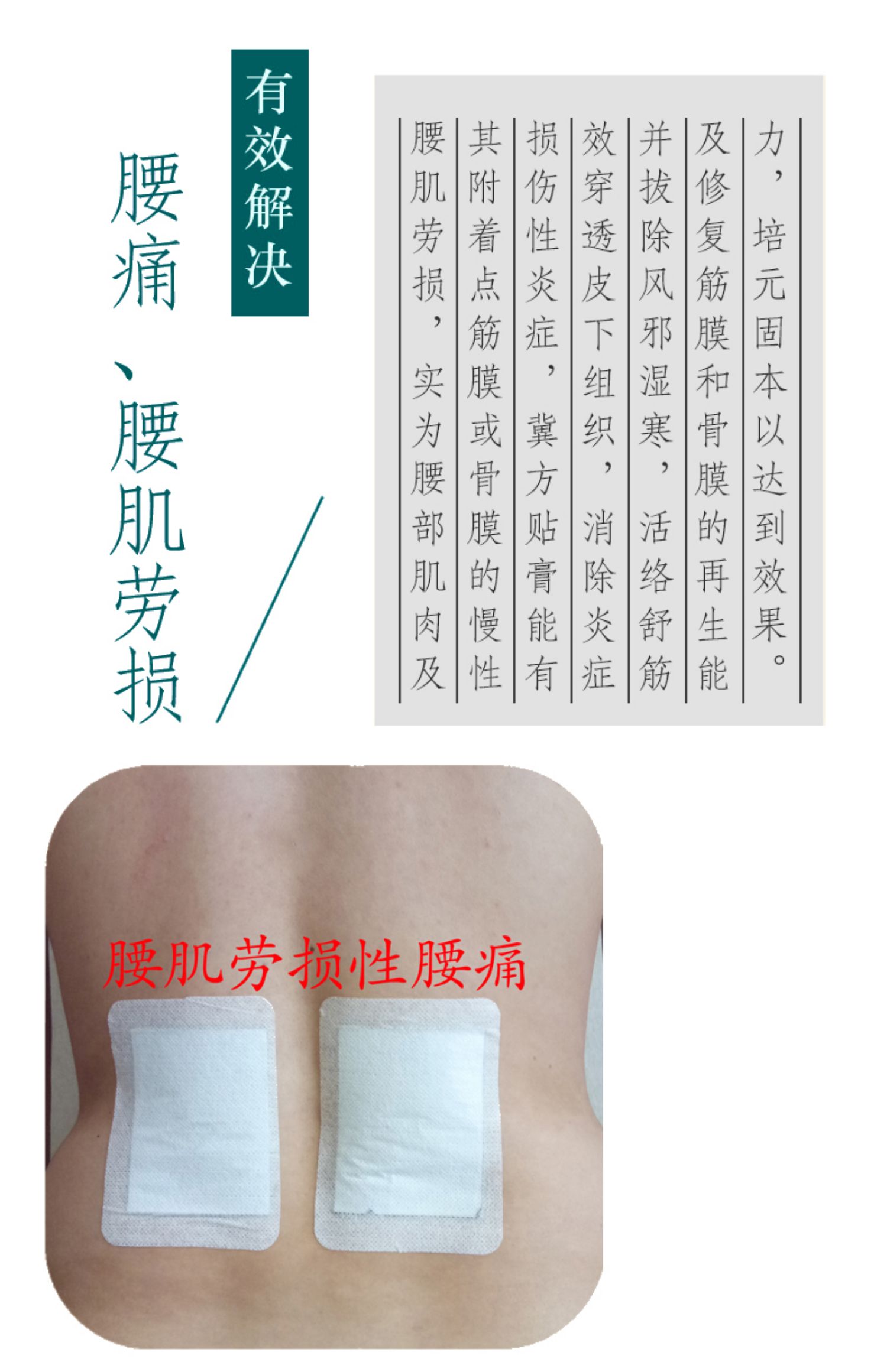 腰椎间盘突出颈椎病贴腰痛腰疼药腰肌劳损贴膏专用压迫神经药两盒共20