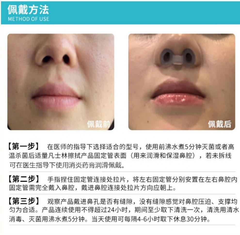 鼻中隔偏曲矫正神器隆鼻综合术后鼻孔支撑器防鼻子增生鼻撑支架鼻夹鼻
