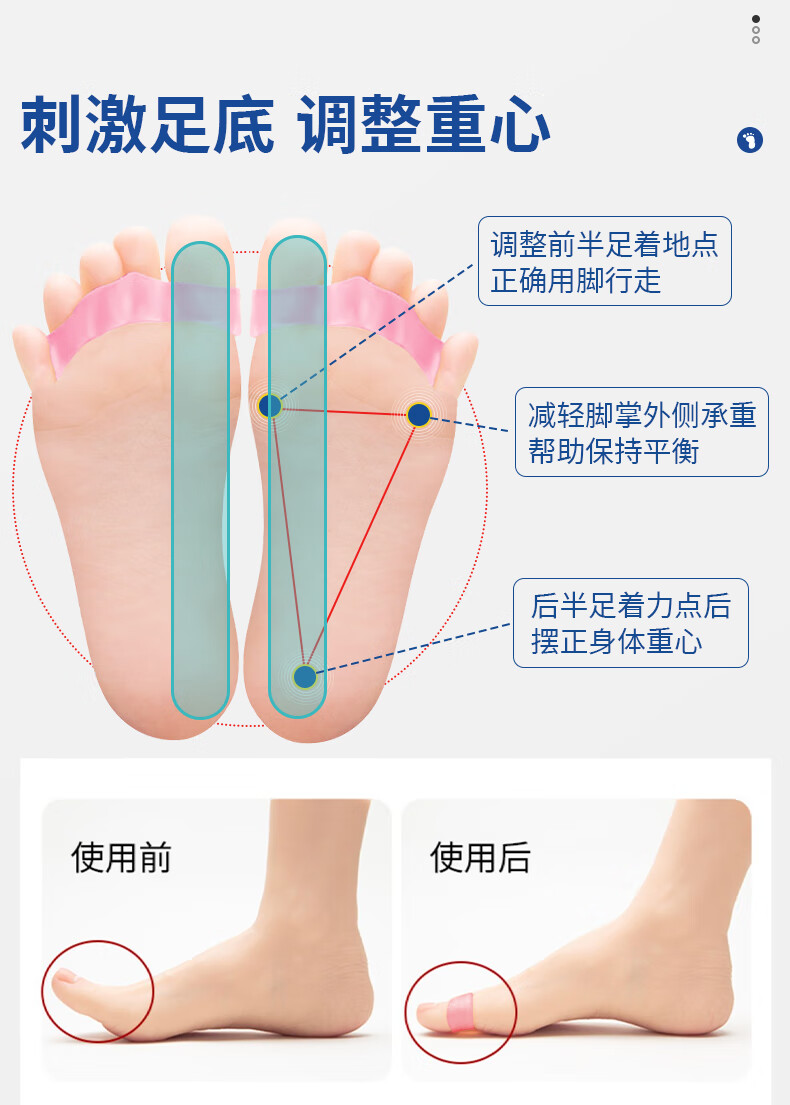 趾环矫正腿型原理图片