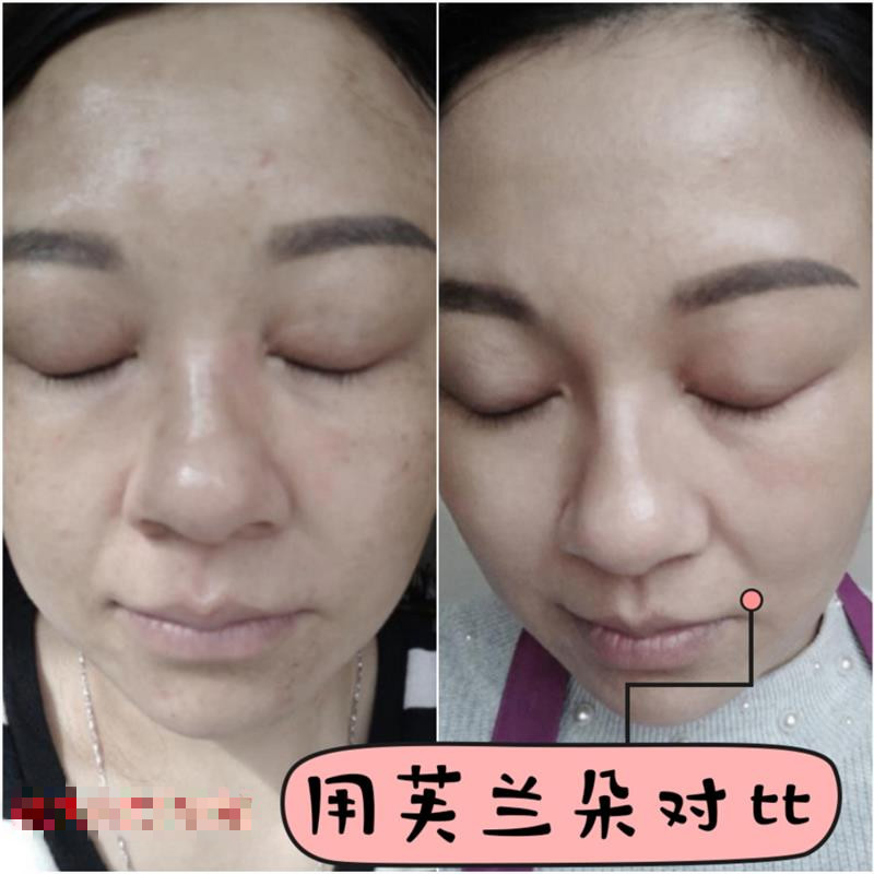 芙兰朵早晚霜套装霜去1黄祛痘印晒斑护肤品微商同款 晚霜( 试用装)