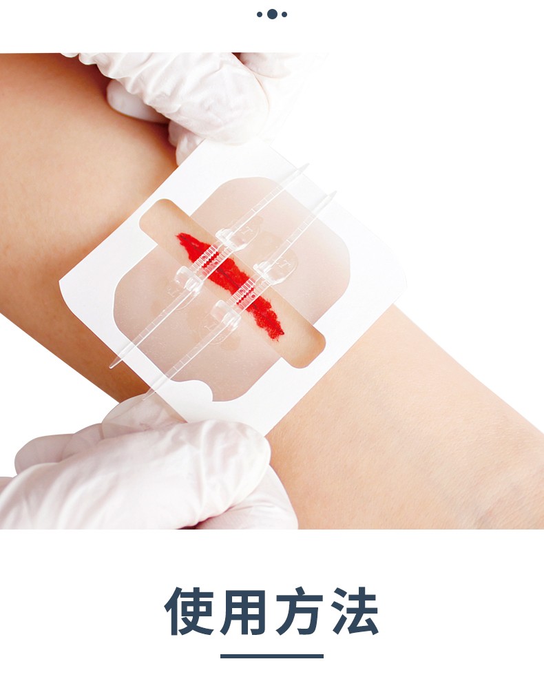 免缝针减张器手术疤痕拉合减张贴拉链式创可贴伤口愈合缝合器胶带可伴