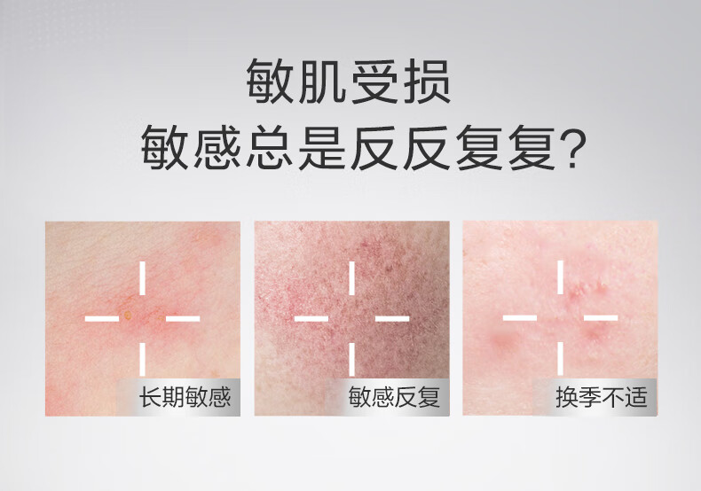 薇诺娜（WINONA）【重磅升级】第二代舒敏保湿特护霜50g 保湿面霜滋润舒缓敏感肌修