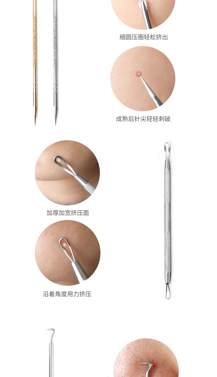阿嚓热（ACARE）粉刺针细胞夹挑暗疮针套装拔去黑头镊子家用美容挤痘痘工具 银尖针+弯勾夹各 1件