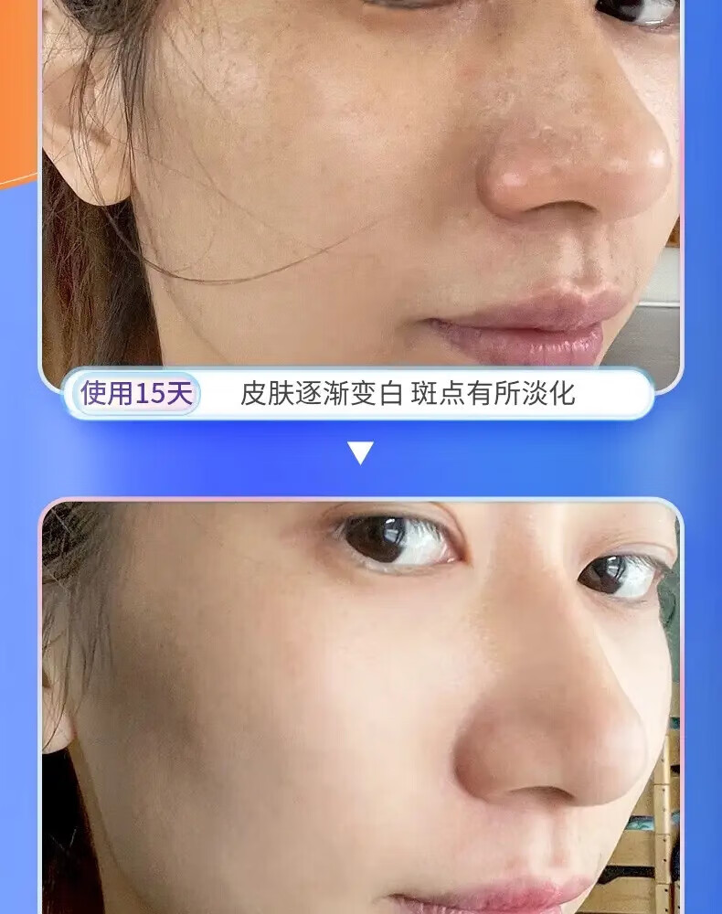 韩鹭美白祛斑霜淡化黑色素去雀斑黄褐斑老年斑晒斑妊娠斑男女可用 一瓶50g【体验装】