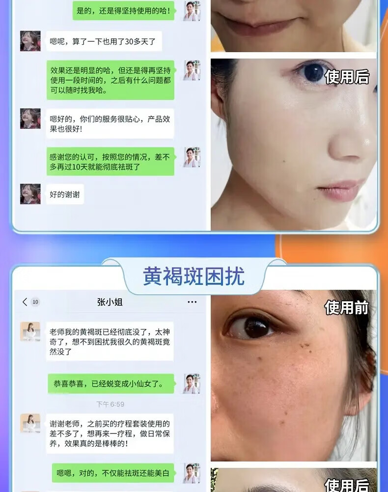 韩鹭美白祛斑霜淡化黑色素去雀斑黄褐斑老年斑晒斑妊娠斑男女可用 一瓶50g【体验装】